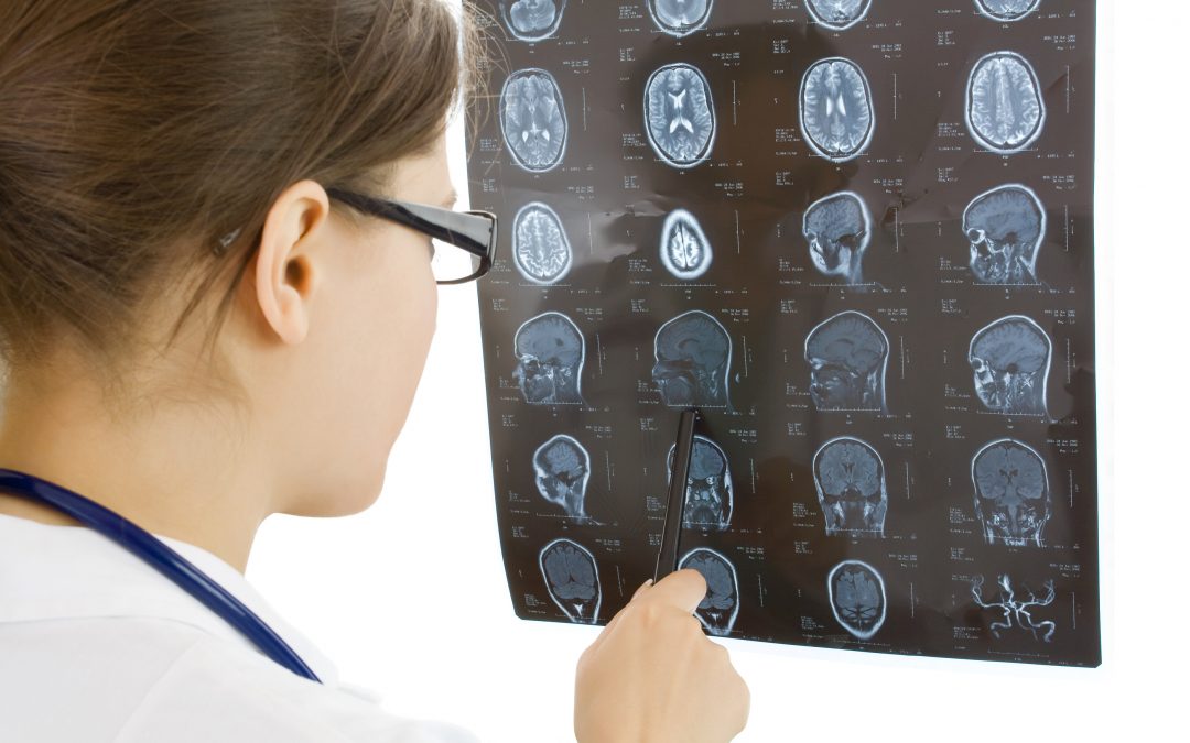 Misdiagnosis and Failure to Diagnose Medical Malpractice